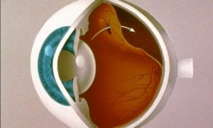 retina-y-macula-3